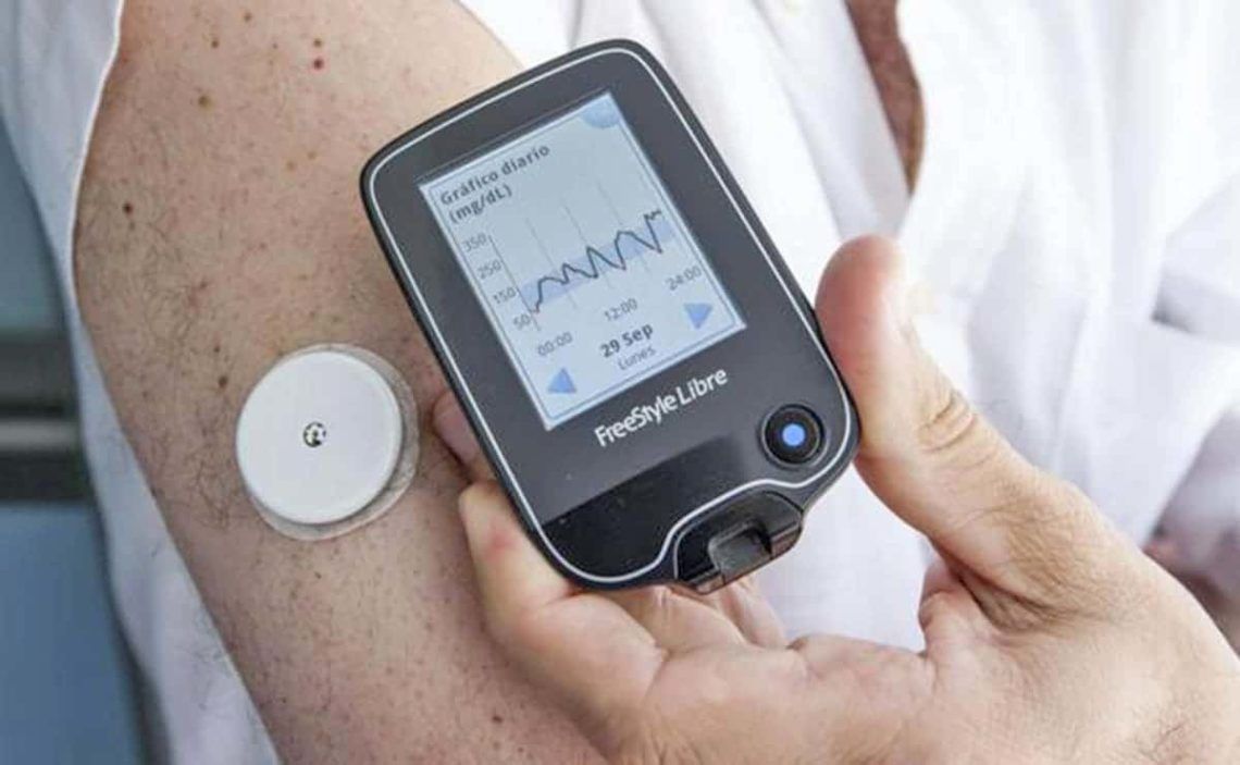 blood glucose monitoring systems