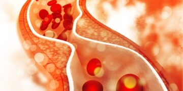We disprove some misconceptions commonly associated to cholesterol
