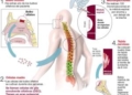 Avances en la investigación para la lesión medular