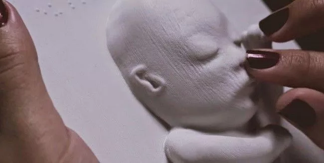 Un ginecólogo reproduce en relieve una ecografia 4D de una mamá ciega