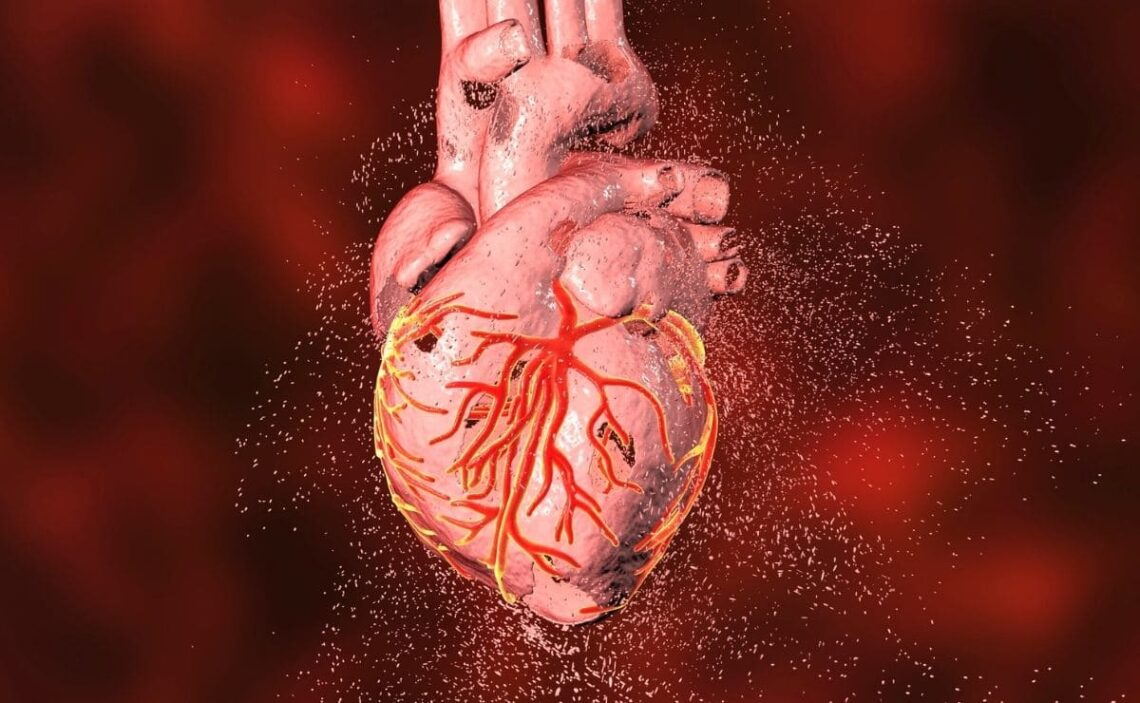 Alimentos riesgo cardiovascular