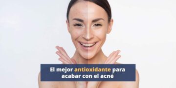 El mejor antioxidante para acabar con el acné