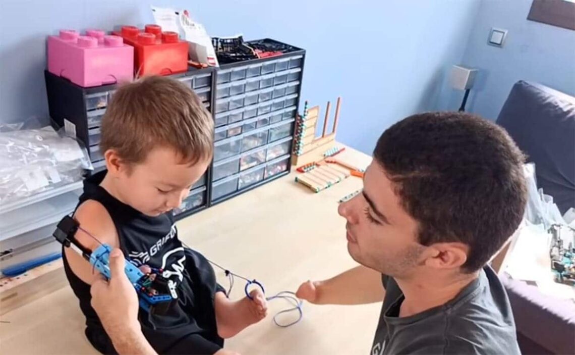 Beknur David Aguilar Discapacidad prótesis