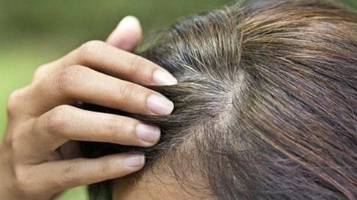 El uso de tintes para disimular las canas aumenta el riesgo de cáncer