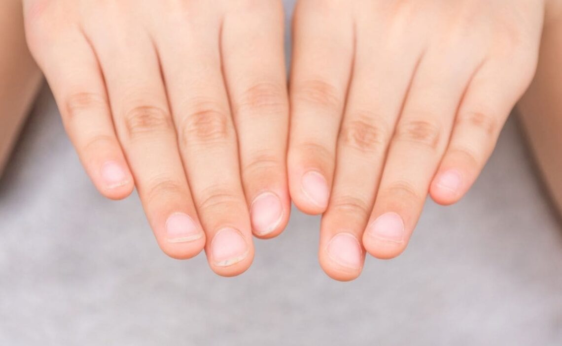 Causas por las que no crecen las uñas