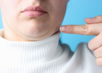 Consejos saludables quemar grasa papada