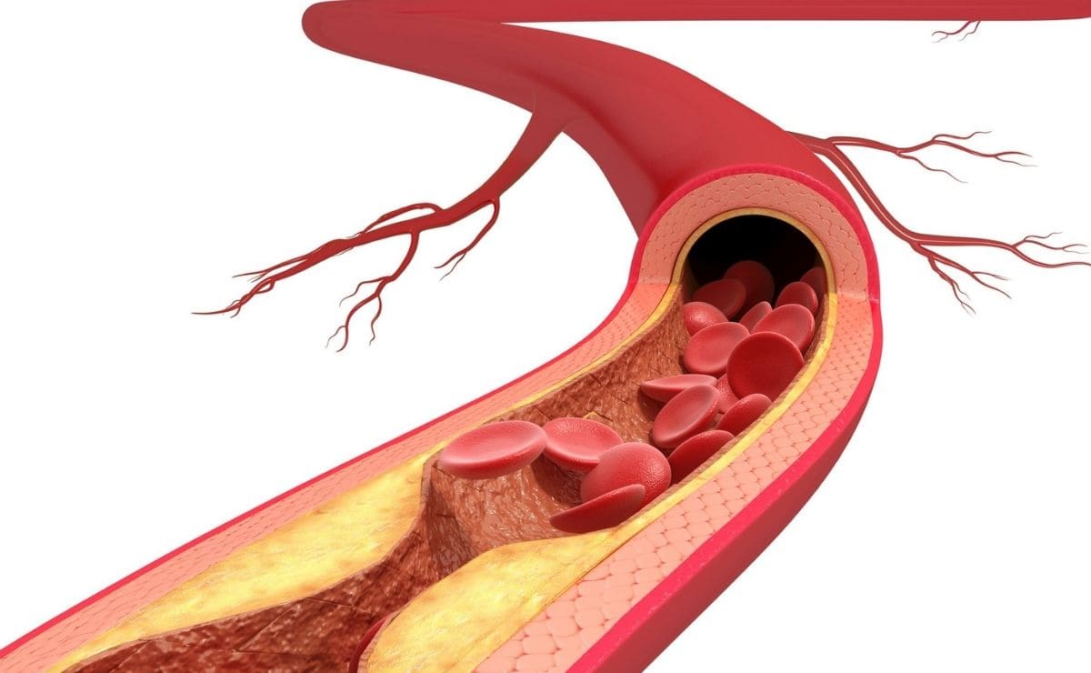 Controlar colesterol para proteger el corazón