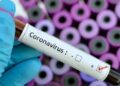 Muestra positiva en Coronavirus