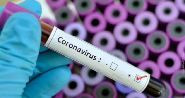 Muestra positiva en Coronavirus