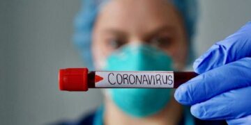 Enfermera sosteniendo una prueba de sangre con coronavirus