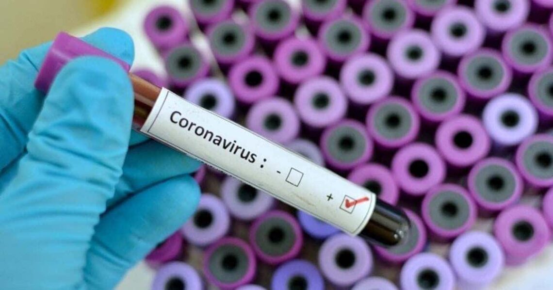 Pruebas coronavirus COVID-19