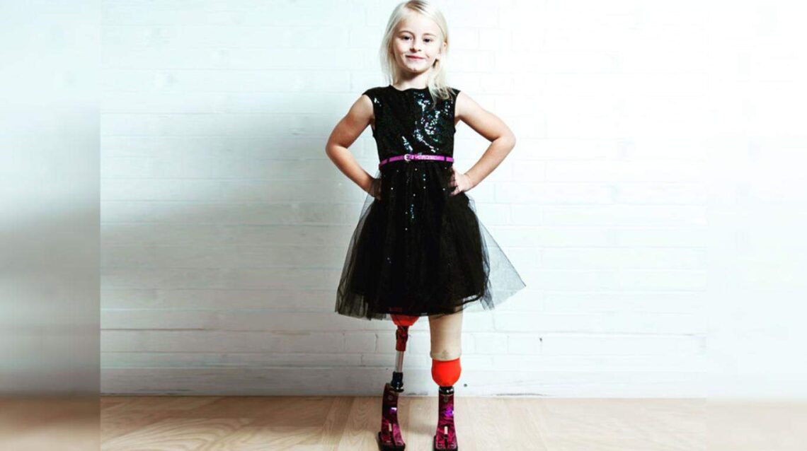 Daisy-May Demetre con prótesis en las piernas