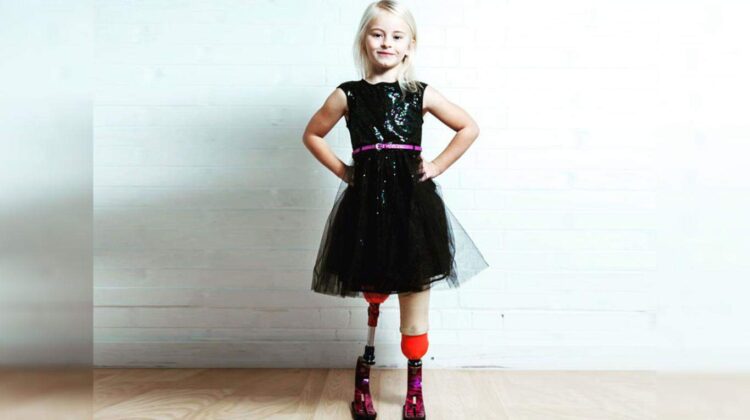 Daisy-May Demetre con prótesis en las piernas