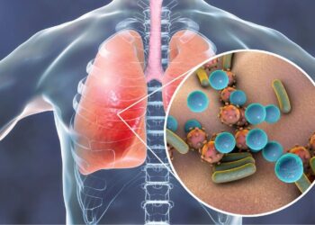 Dengue Influenza Coronavirus infeccion respiratoria