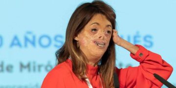 Mujer con una enfermedad rara