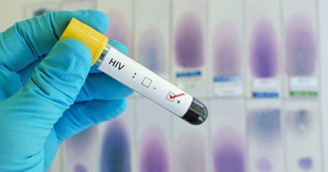 Confirman la cura del sida en un paciente tras más de dos años sin medicación