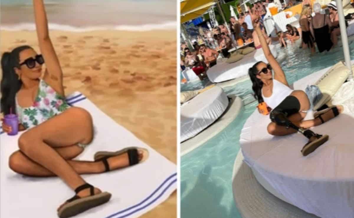 Imagen editada modelo con protesis