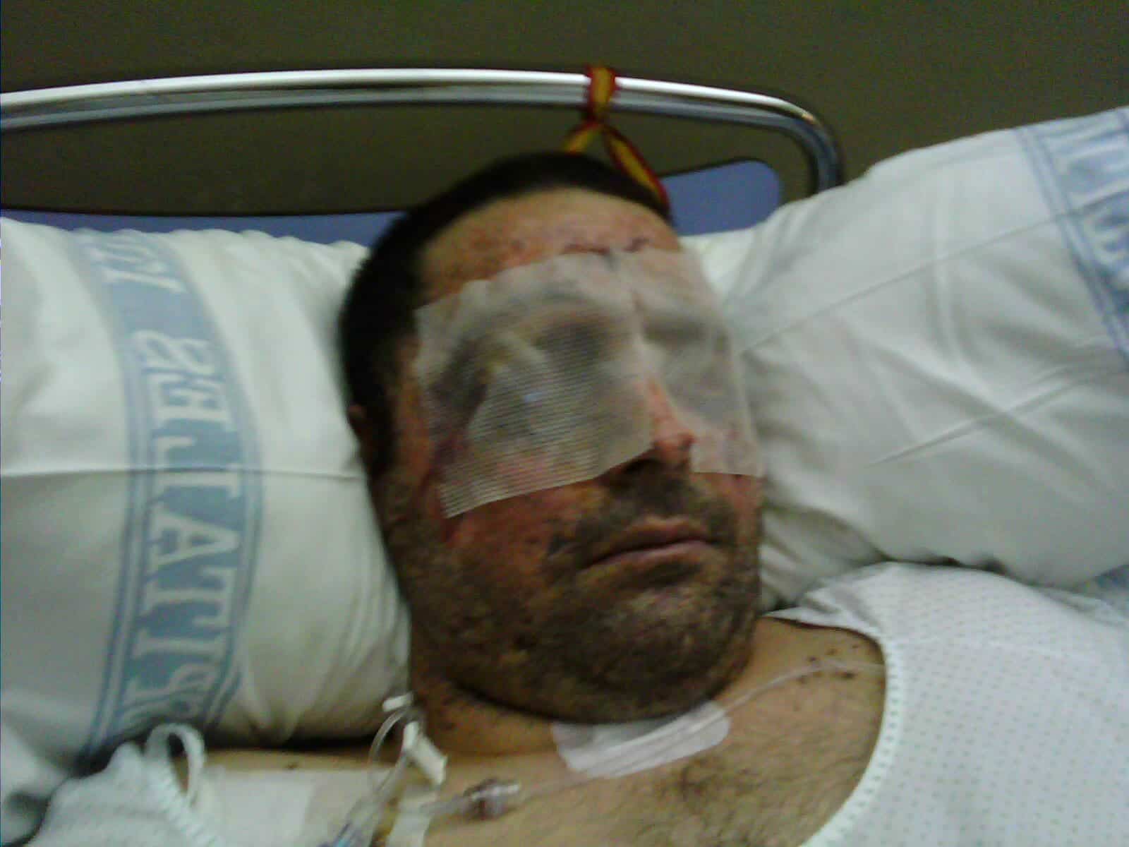 José Manuel durante su recuperacion tras el siniestro con una mina.