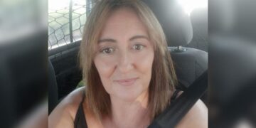 Macarena, mujer con síndrome de Arnold Chiari