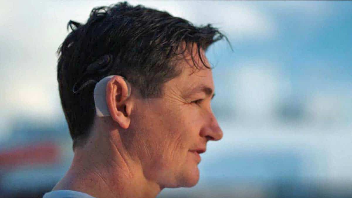 Marcos Lechet implante coclear