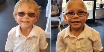 Olly antes y después de afeitarse la cabeza
