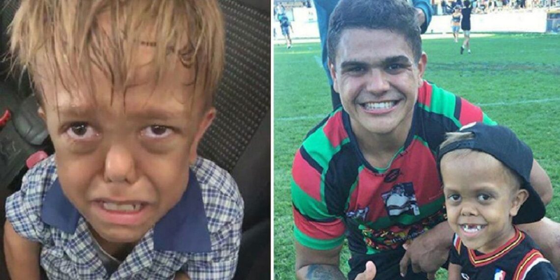 Quaden Bayles junto con uno de los jugadores del equipo