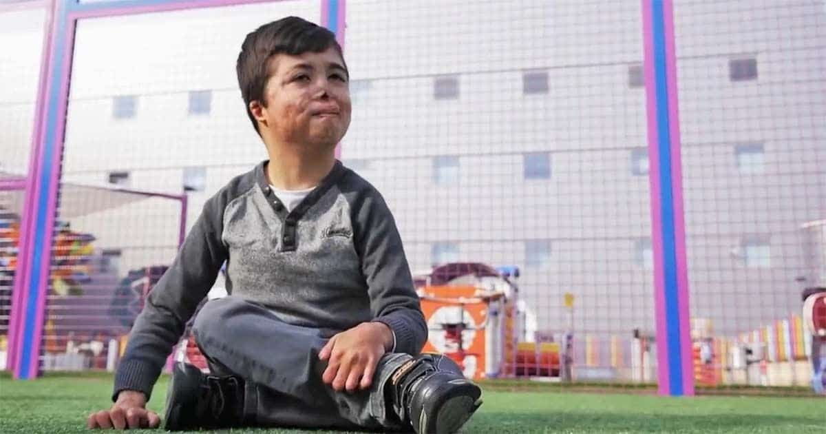 Raul, un niño murciano de 9 años con una enfermedad rara única