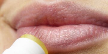 Remedios caseros labios