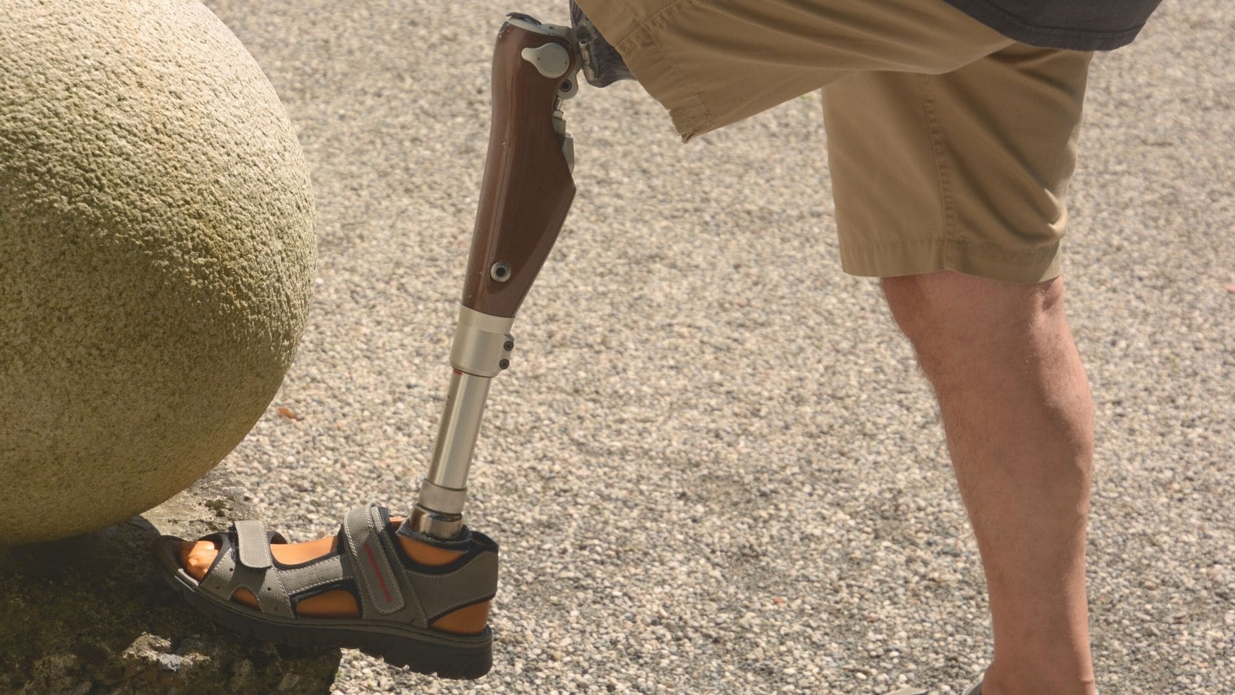 Revisar prótesis verano