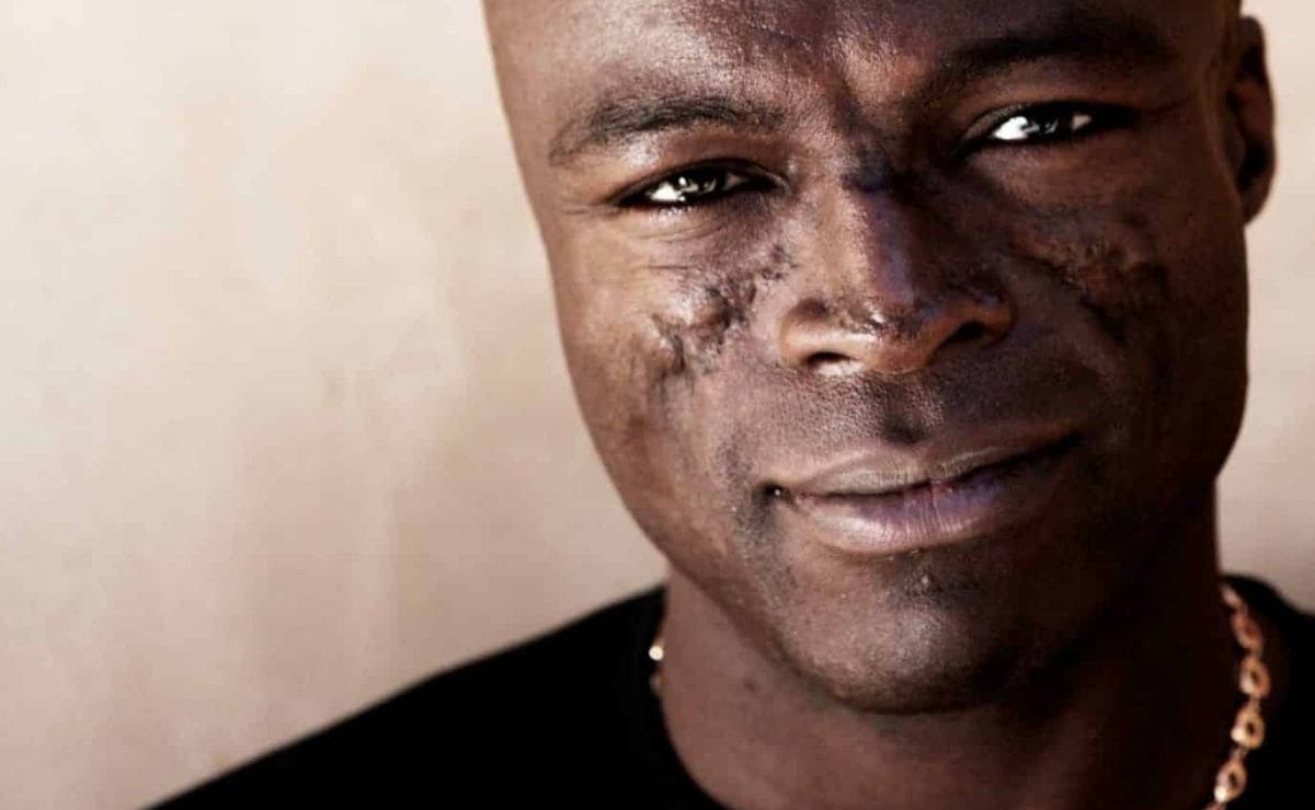 Las cicatrices de Seal son culpa del Lupus