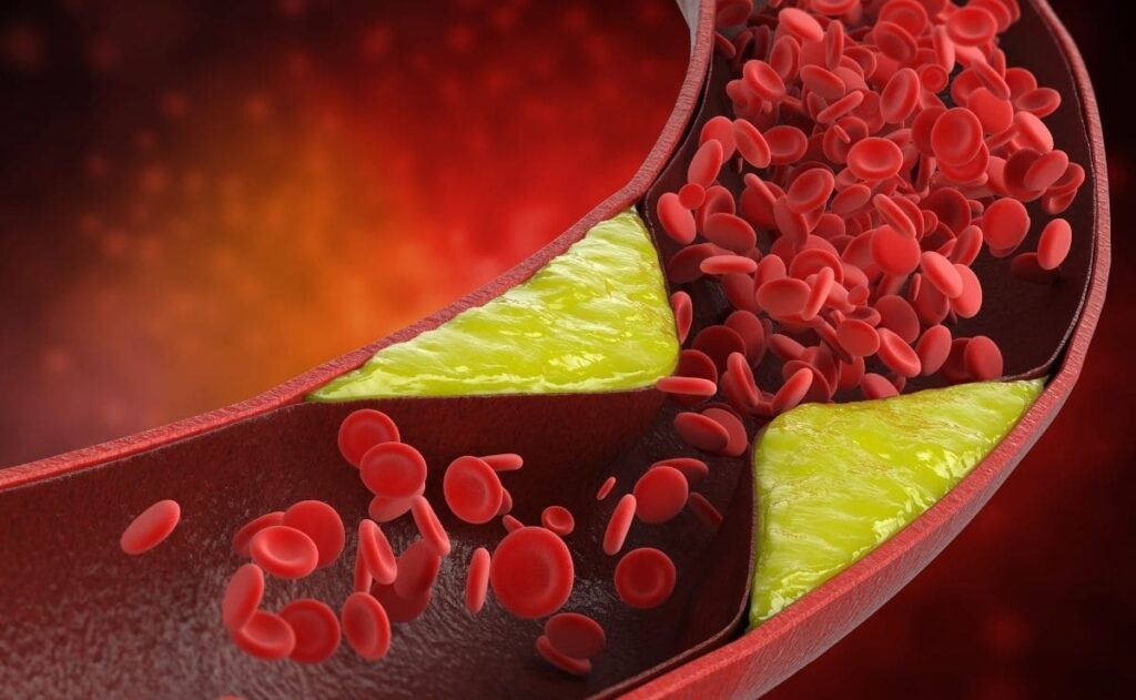 Superalimento colesterol membrillo
