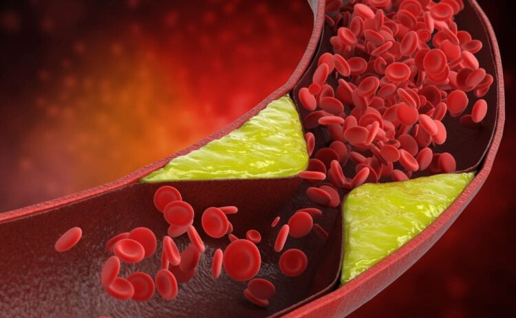 Superalimento colesterol membrillo