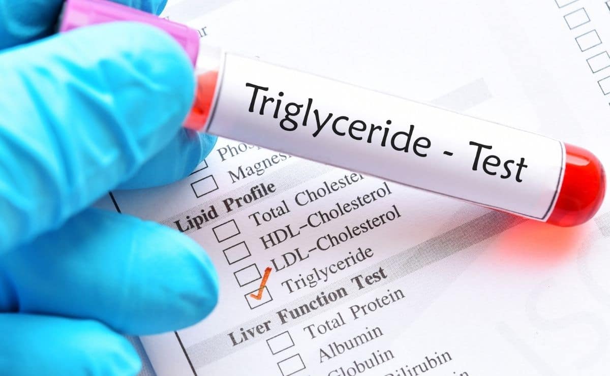 Triglicéridos test