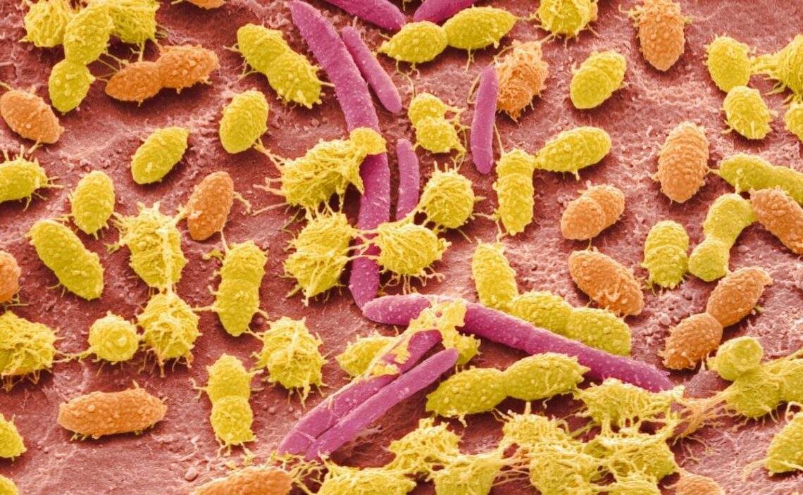 alimentos afectan microbiota intestinal