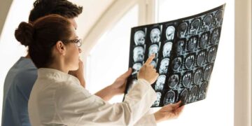 Un fármaco reduce un 27% el deterioro cognitivo leve en personas con Alzheimer