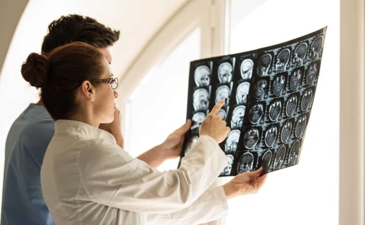 Un fármaco reduce un 27% el deterioro cognitivo leve en personas con Alzheimer