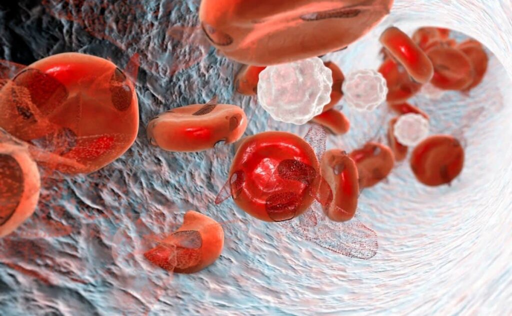 Los síntomas clave para detectar anemia y evitar la falta de hierro