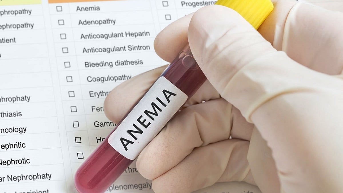 Anemia