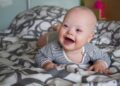 Bebé con síndrome de Down tirado en la cama