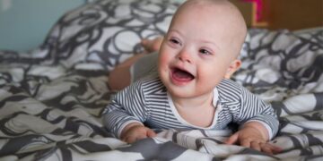 Bebé con síndrome de Down tirado en la cama