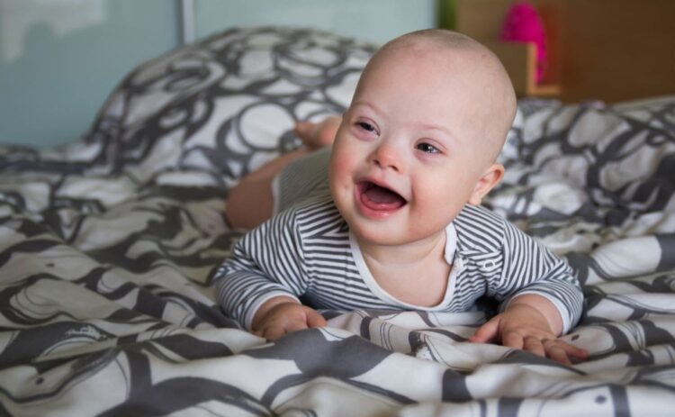 Bebé con síndrome de Down tirado en la cama