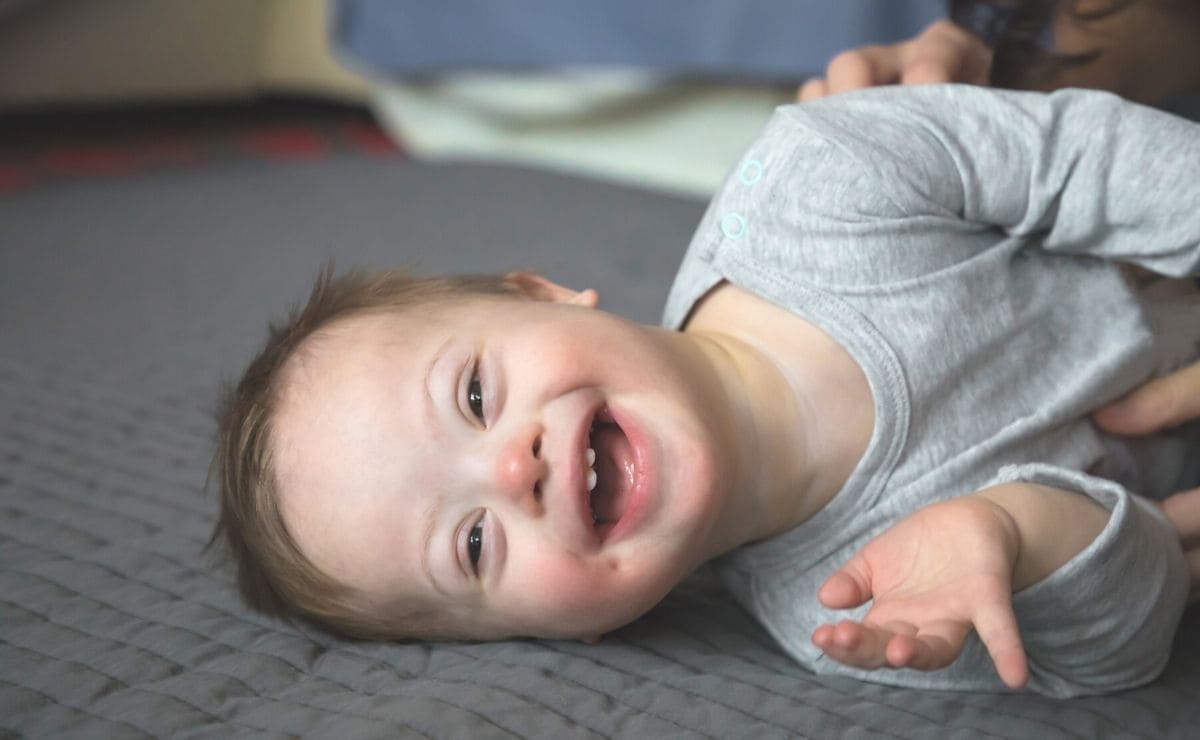 bebe con sindrome de down discapacidad