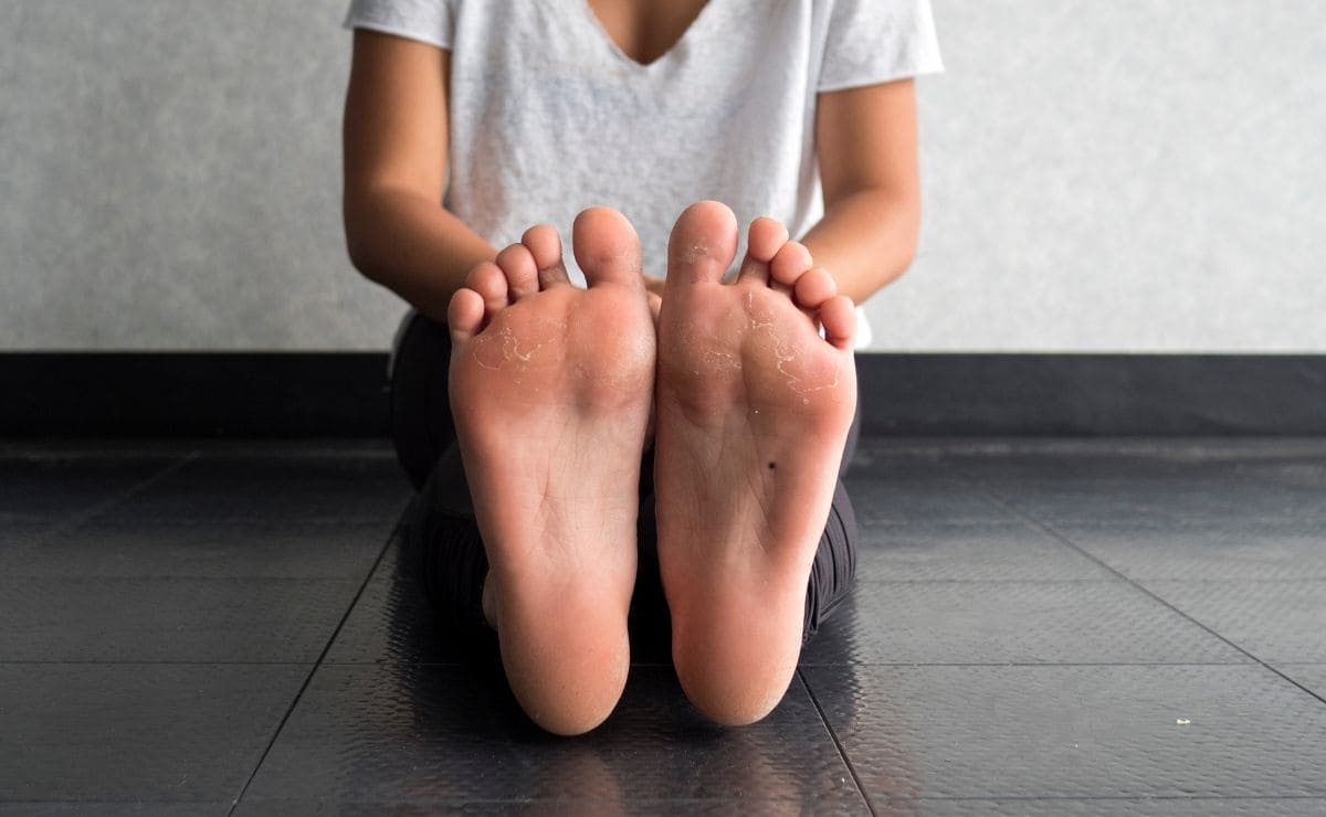 bicarbonato de sodio callos pies