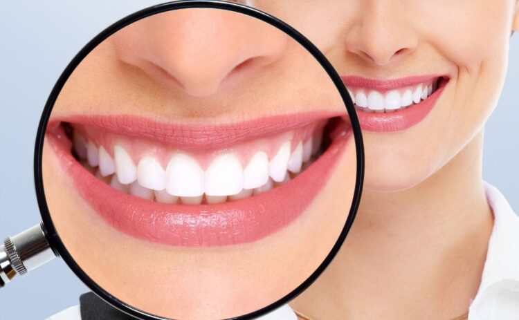 blanquear dientes bicarbonato