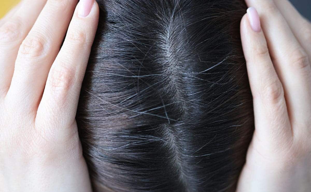 El remedio casero con bicarbonato para evitar las canas en el pelo