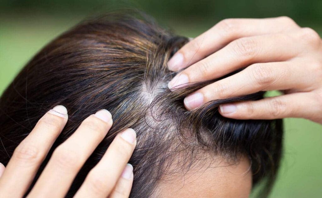 El truco con vinagre para eliminar las canas de manera 100% natural