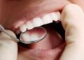 Caries dentista