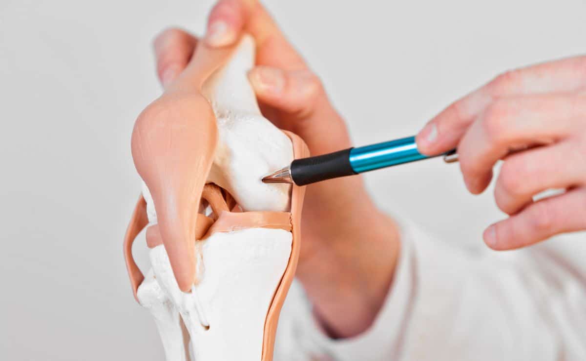 3 hábitos que se pueden realizar si se sufre de desgaste de cartílago