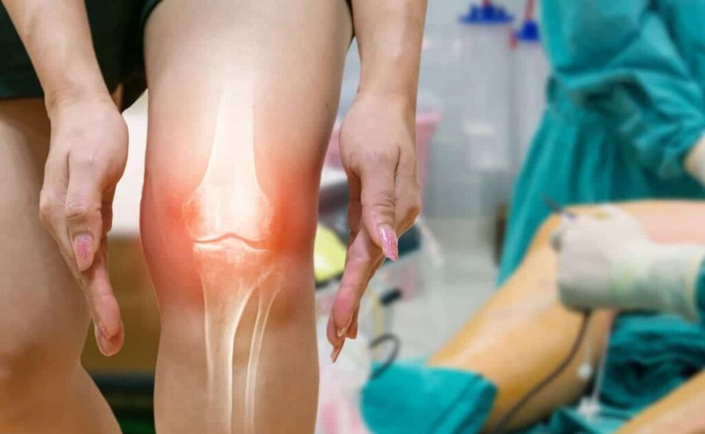 La ortiga es una planta muy beneficiosa como remedio natural para los cartílagos
