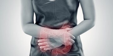 causas dañar flora intestinal colitis ulcerosa